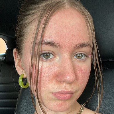 Natalie